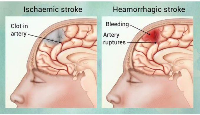 Neurology