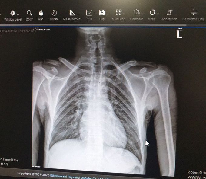 What is your diagnosis?
