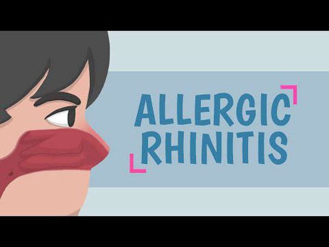 Rhinitis - Animation