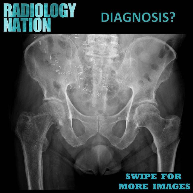 What's your diagnosis?