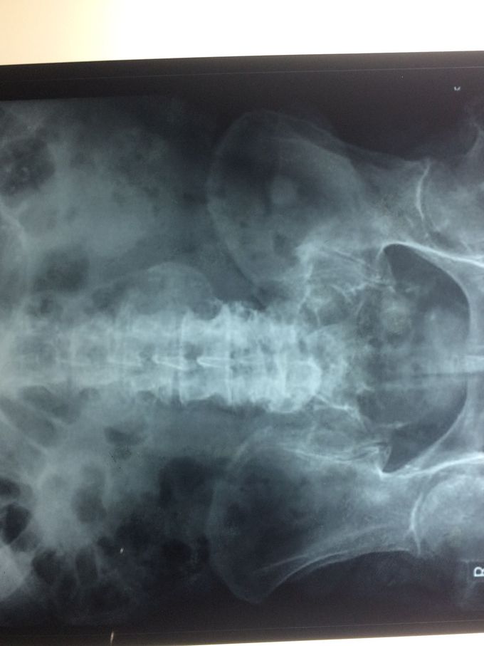 Diagnosis??