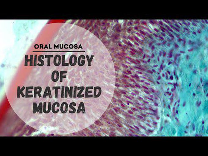 GIT Histology- Masticatory Oral Mucosa 