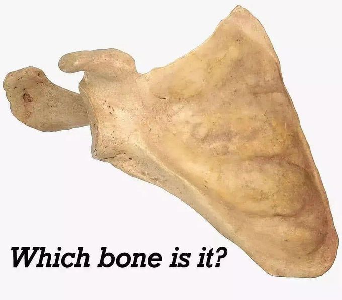 Identify the Bone