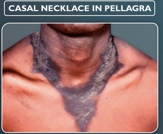 Casal Necklace in Pellagra