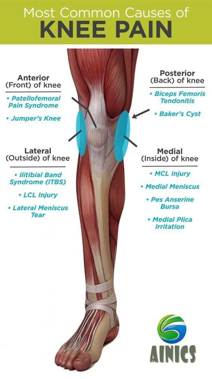 Most common causes of knee pain
