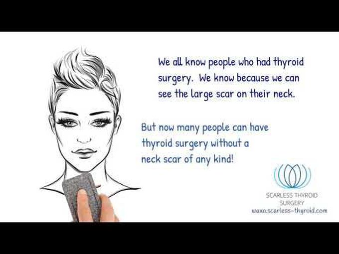 Scarless Robotic Thyroid 
Surgery-Overview