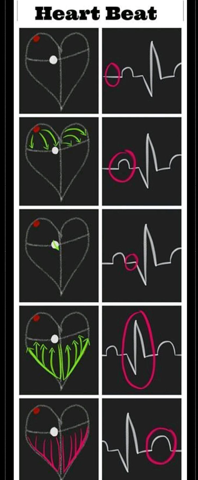 Cardiac