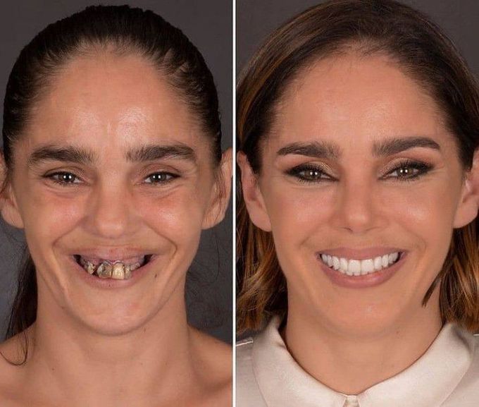 Amazing smile makeover