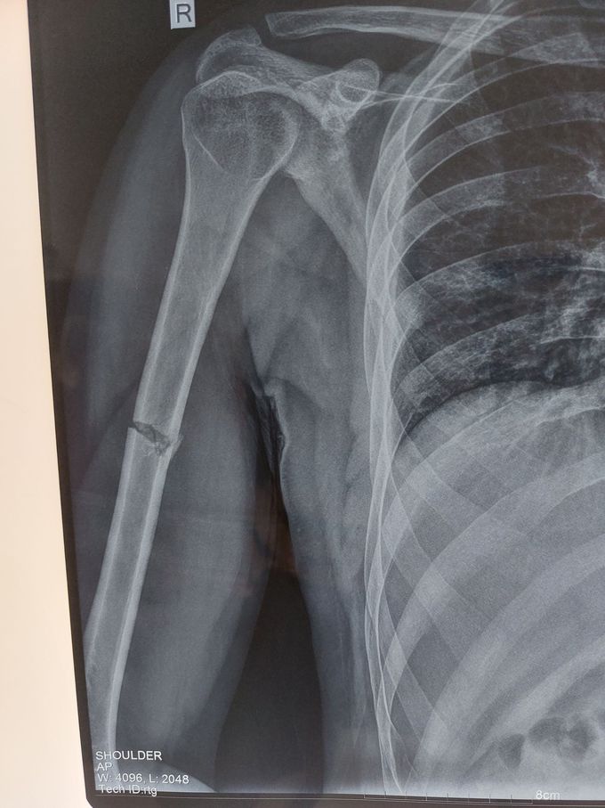 Ortopaedics