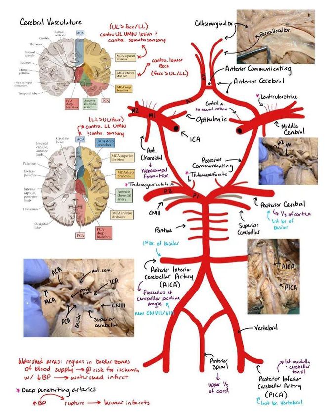 Circle of Willis