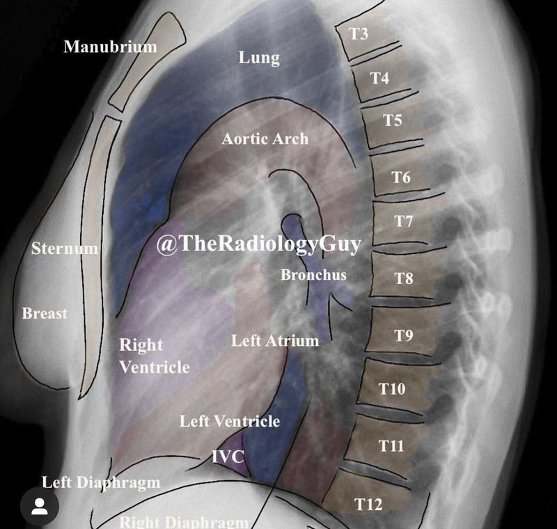 Chest Xray - MEDizzy