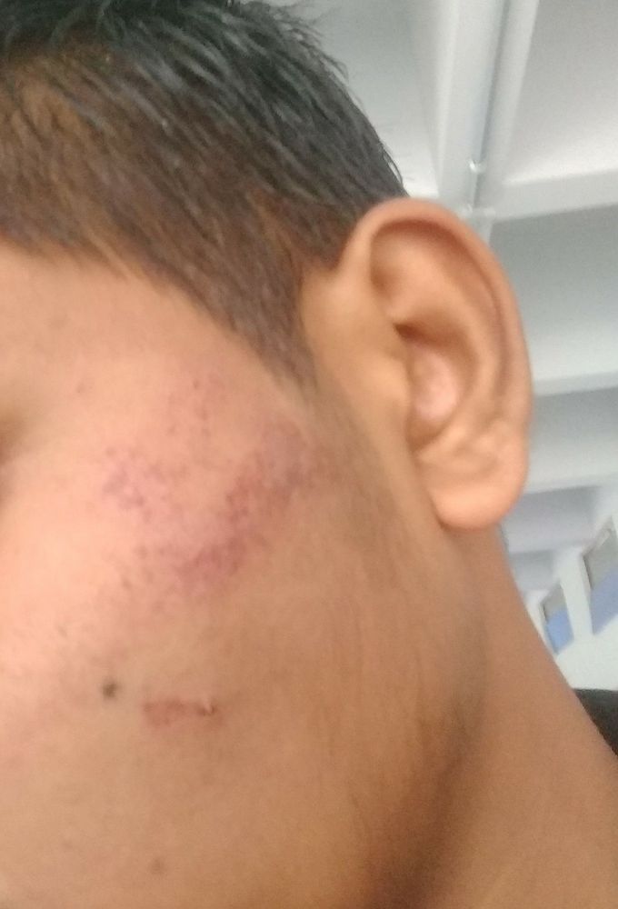 Skin ellergy?