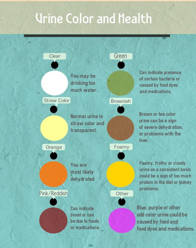 Urin colour