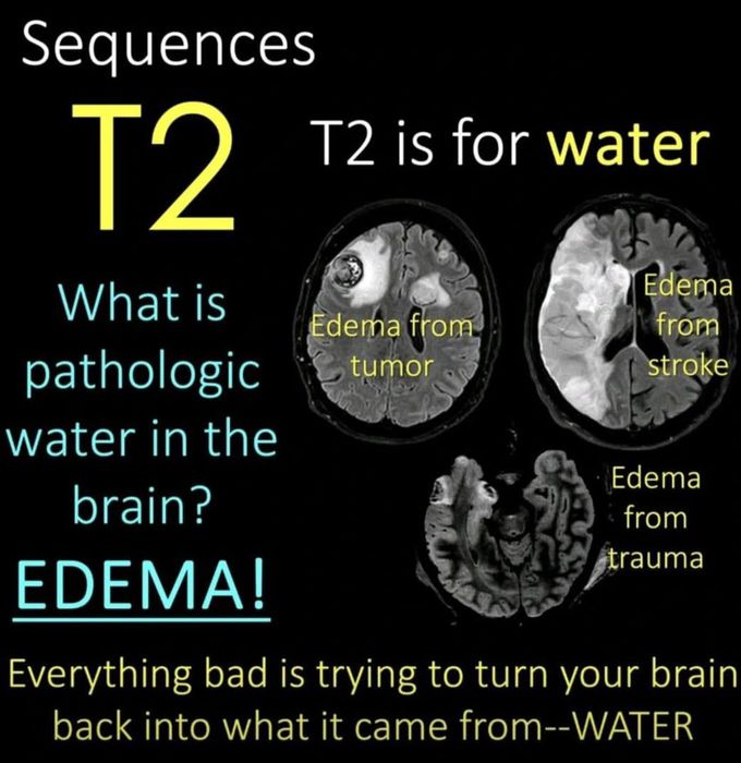 How to Read MRI IV