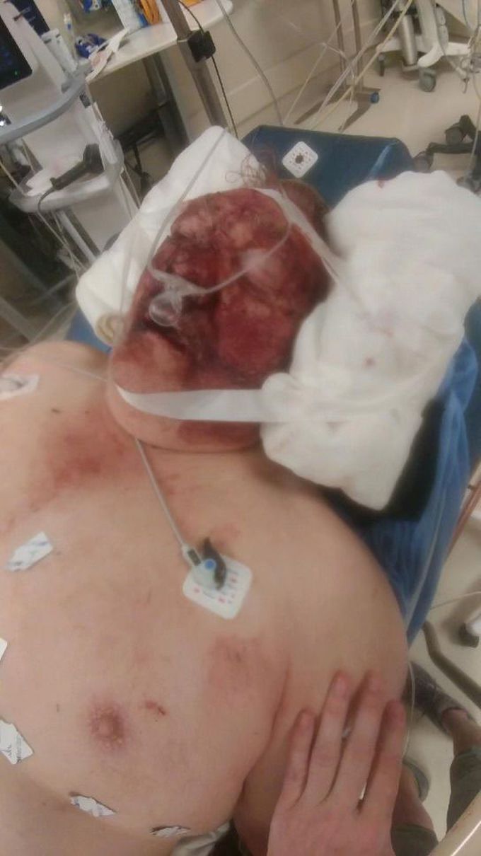 Motorcycle accident