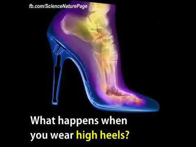 Risks of Wearing High Heels