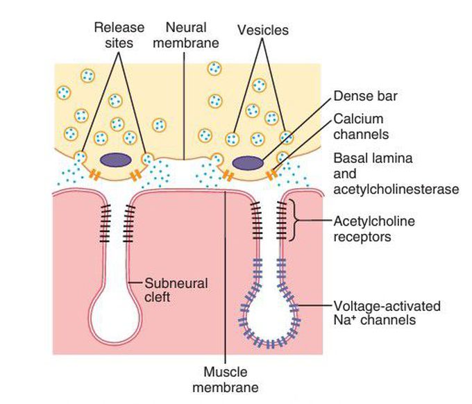 Neuroma junction