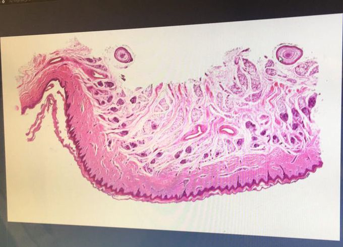 Guess.. from which tissue 🤷🏻‍♀️