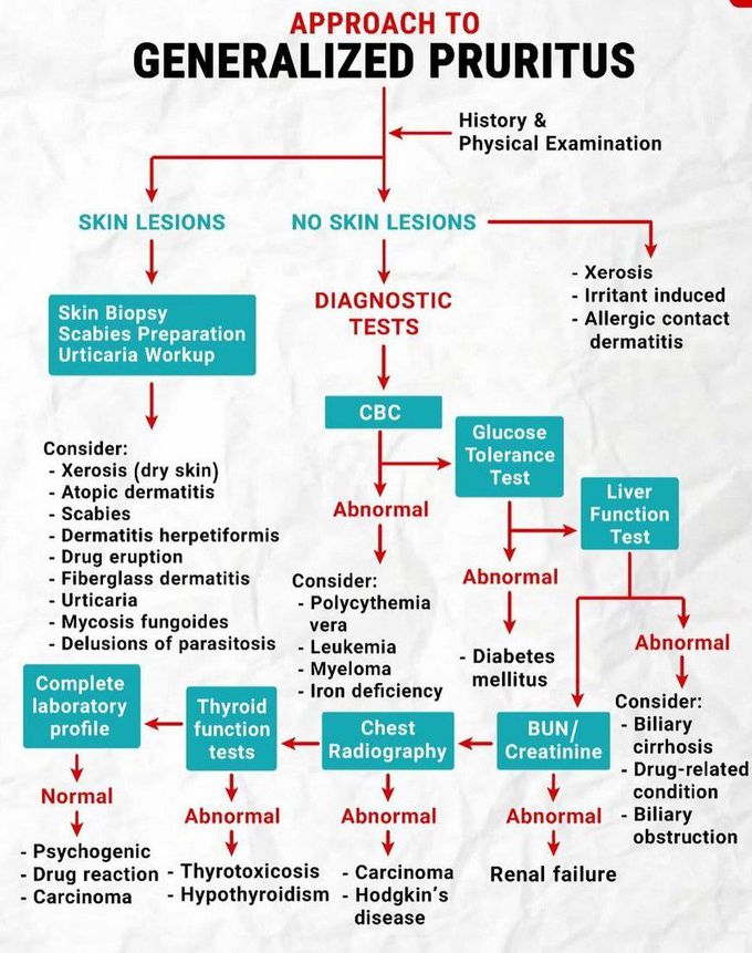 Approach to Generalized Pruritus