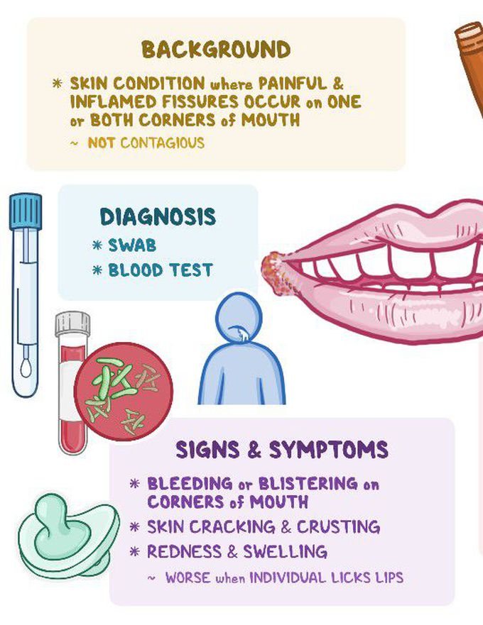 Symptoms of Angular cheilitis