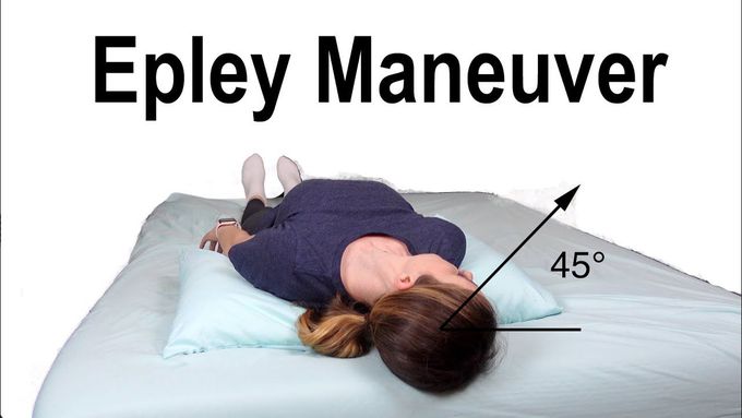 Epley Maneuver | Treating BPPV