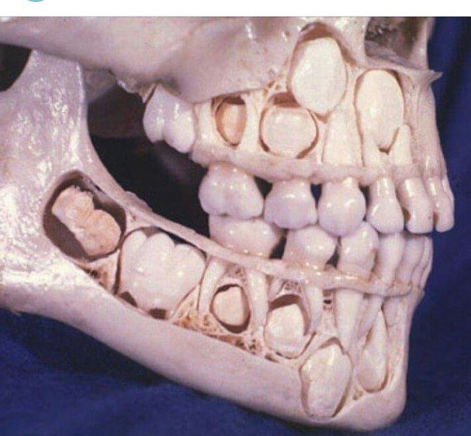 Child mouth before loosing their teeth