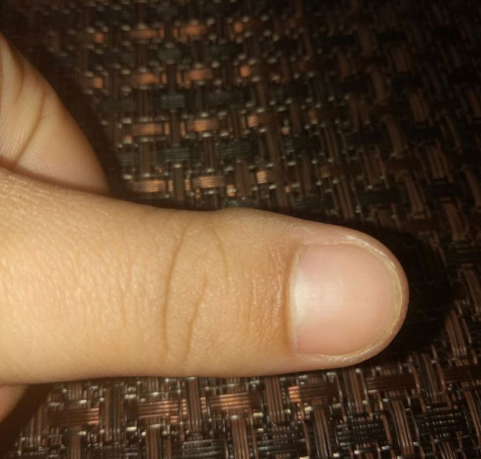 Diagnosis?