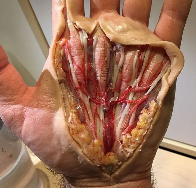 Can you name the tendons?