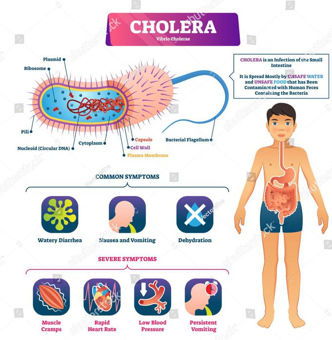 Cholera