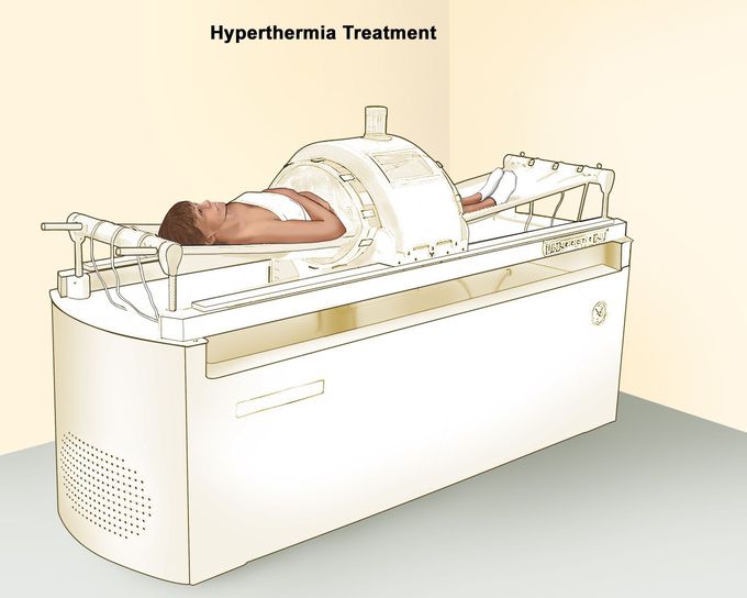 What are the treatment of hyperthermia?
