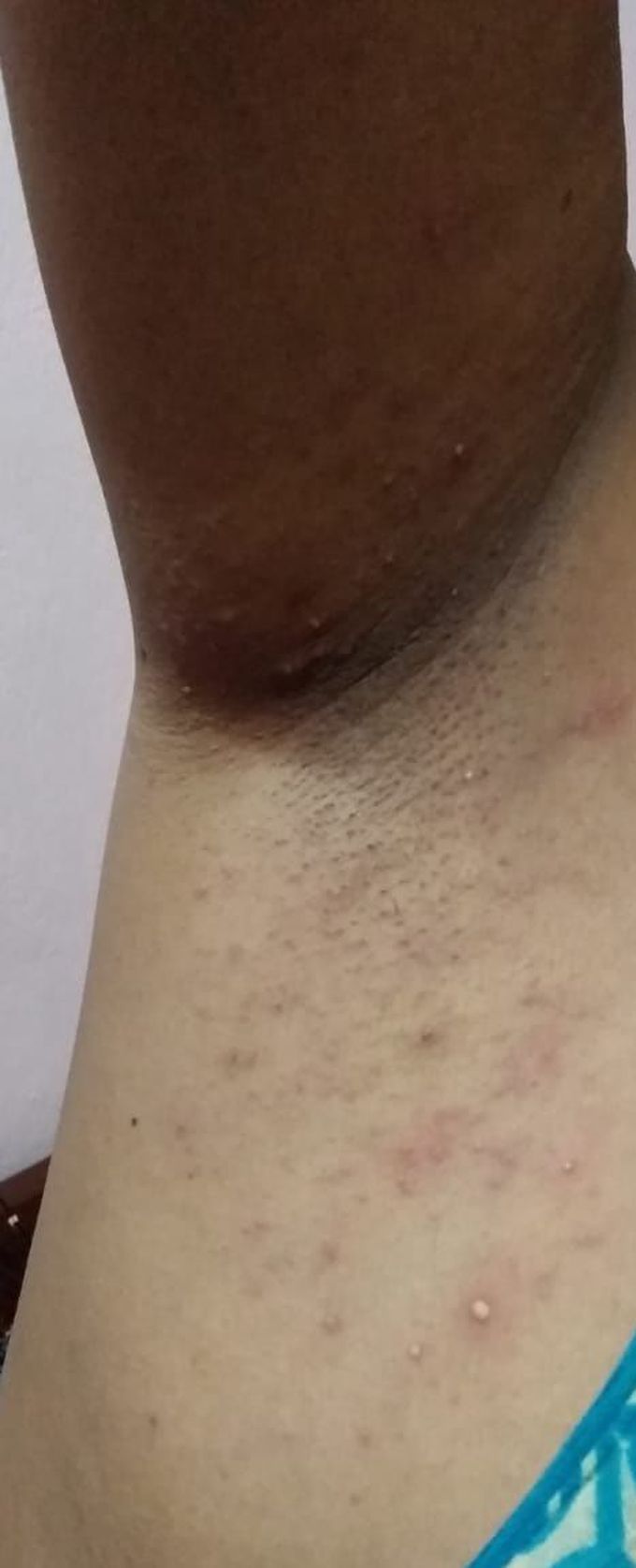 Diagnosis plzzz