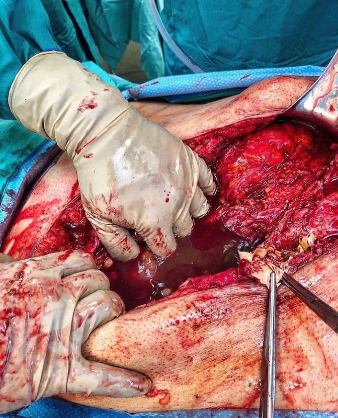 trauma surgery