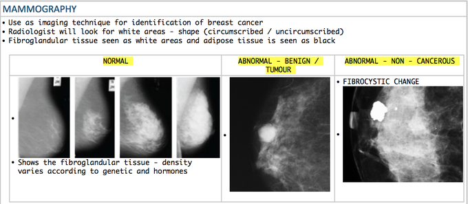 Understanding mammography
