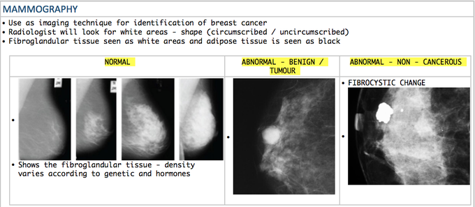 Understanding Mammography - MEDizzy