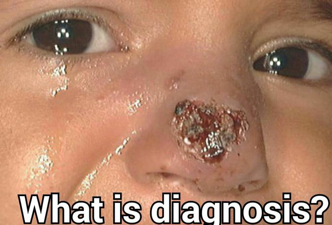 What is your dx?