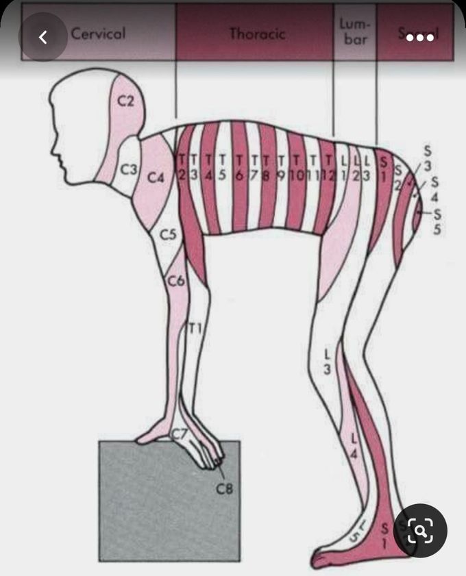 Dermatomes