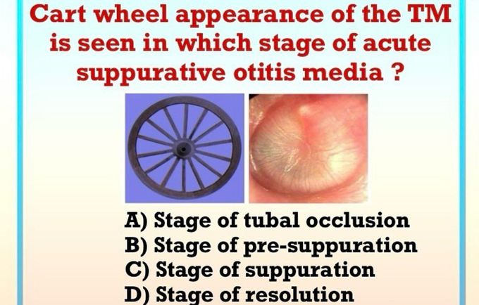 Cart Wheel Appearance - MEDizzy