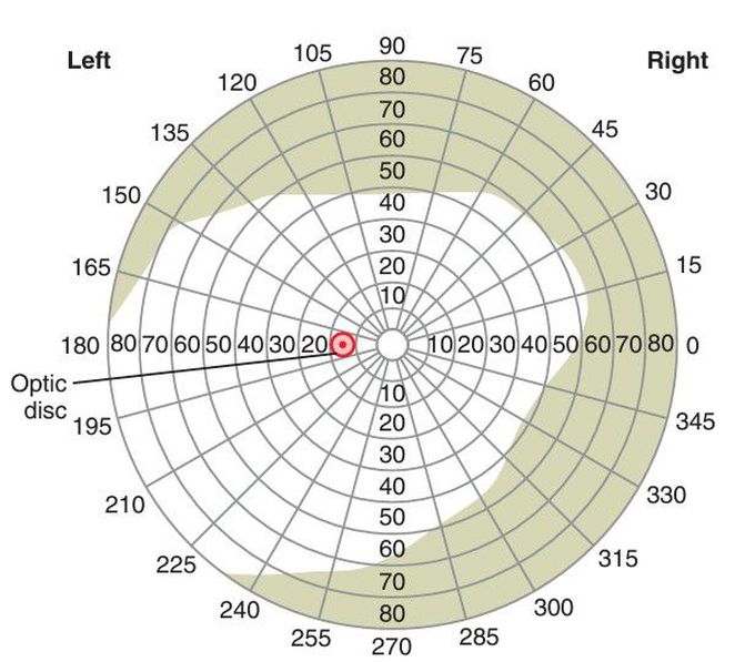 Perimetry chart