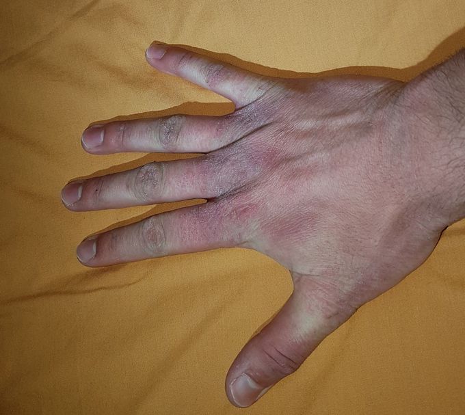 What's your diagnosis ?