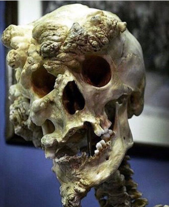 What is your diagnosis??