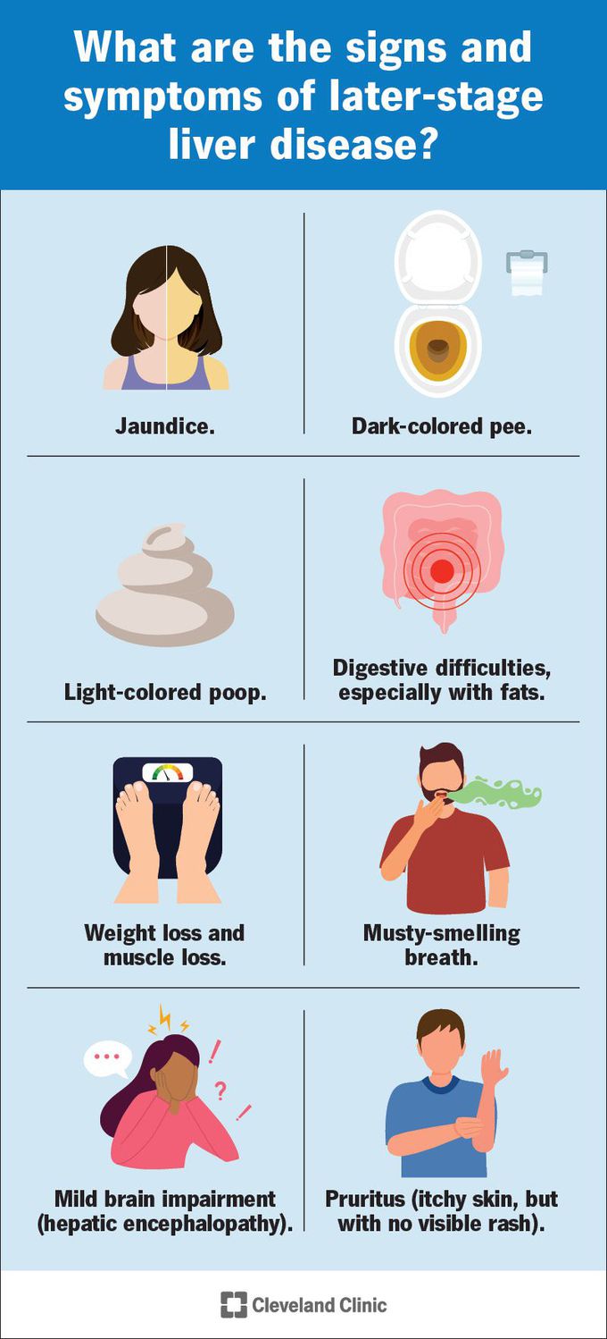 Symptoms of chronic liver disease