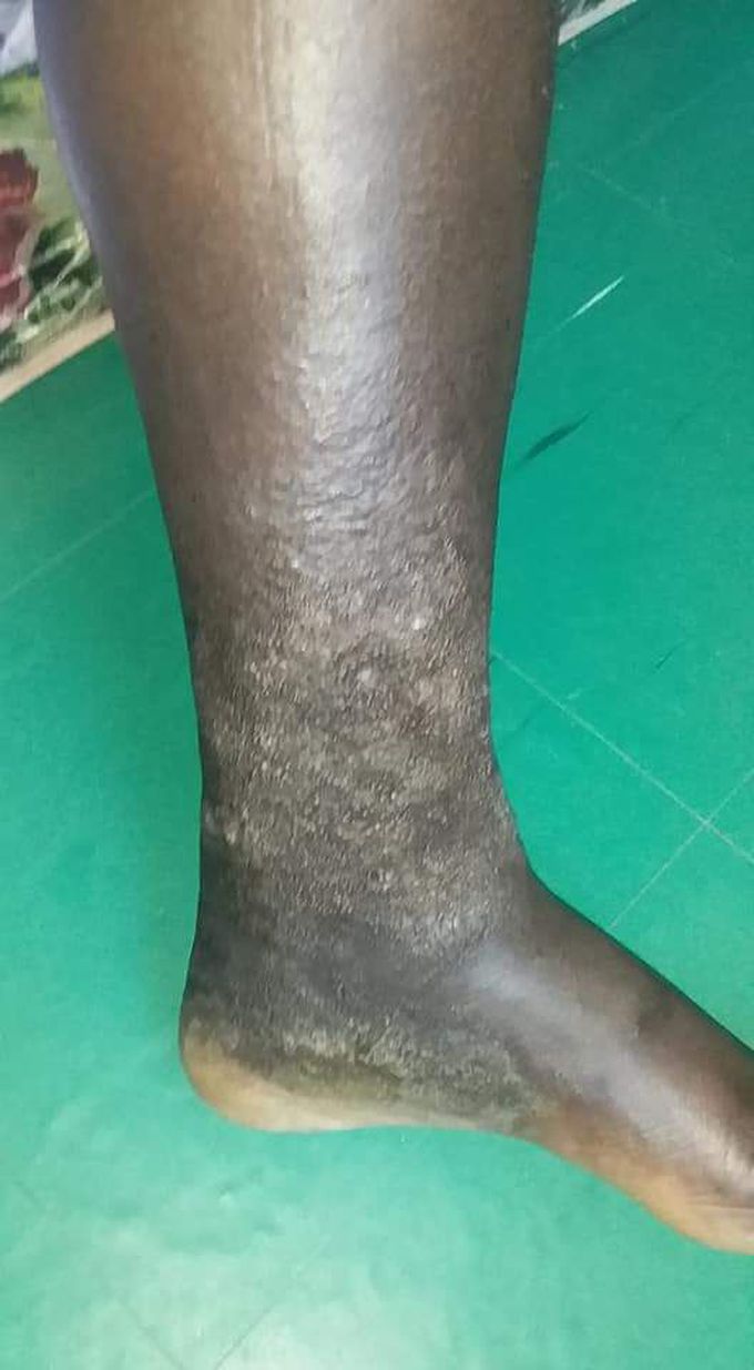 Suggests Diagnosis and Treatment