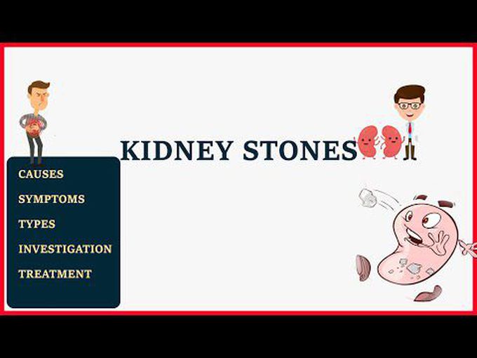 Introduction to kidney stones