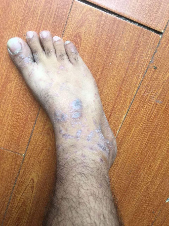 Diagnosis and treatment