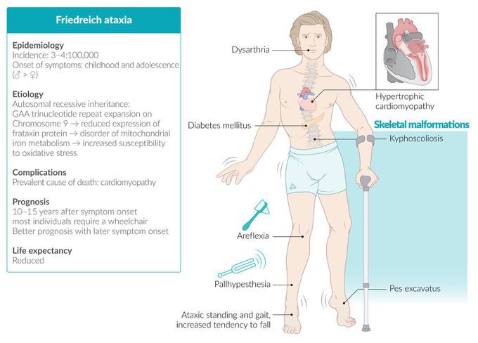 Fiiedreich ataxia