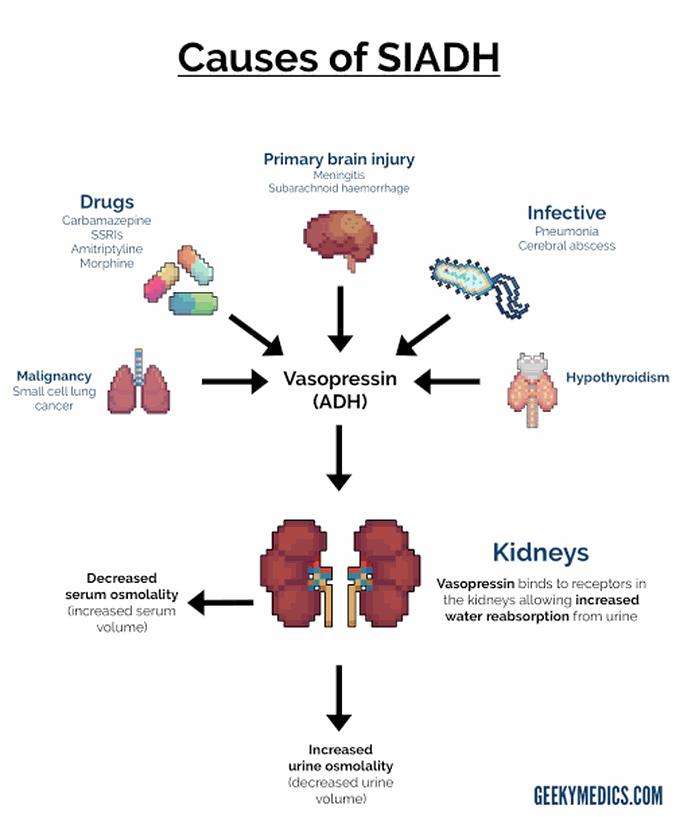 Syndrome of inappropriate ADH Secretion