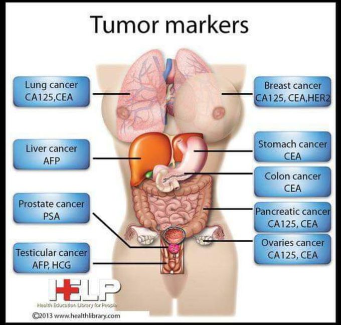 Tumor marker....