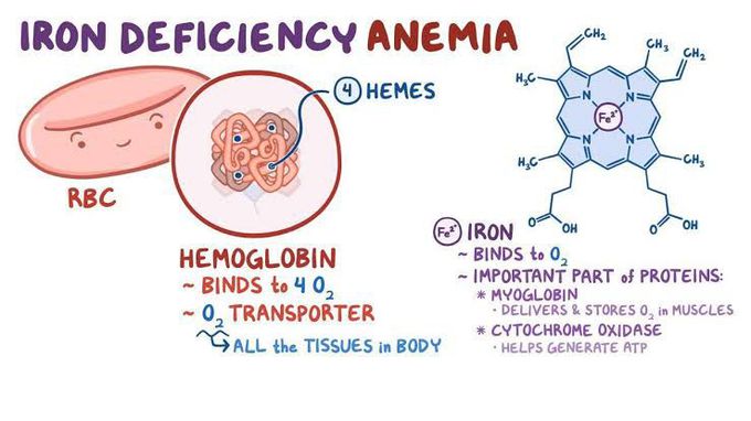 Iron deficiency Anemia