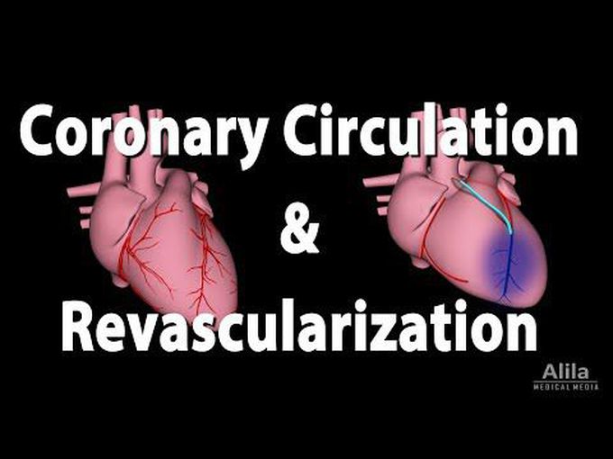 Coronary Circulation and 
Revascularization - 3D model