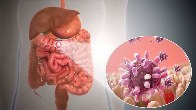 Symptoms of viral gastroenteritis
